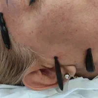حجامت/بادکش/زالو/ناف گیر/ماساژدرمانی درمنـزل شـما|خدمات آرایشگری و زیبایی|کرمانشاه, |دیوار