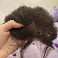 پروتز مو طبیعی ، پروتز جلوی سر ، نصب با سه گیره|آرایشی، بهداشتی، درمانی|ری, دیلمان|دیوار