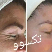 رفع ریشه ای مشکلات پوست،مو