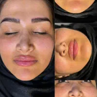 نیازمند مدل خانوم بوتاکس و فیلر و... بدون پرداختی|خدمات آرایشگری و زیبایی|اهواز, گلستان|دیوار