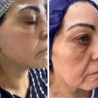 تخفیف مشاوره خدمات زیبایی وجراحی صورت  بدن|خدمات آرایشگری و زیبایی|تهران, میدان ولیعصر|دیوار