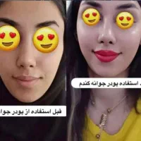 پری صورت|آرایشی، بهداشتی، درمانی|اهواز, امانیه|دیوار