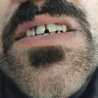 دندانپزشکی با تخفیف ٪40|خدمات آرایشگری و زیبایی|بروجرد, |دیوار