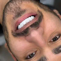 دنداپزشکی کامپوزیت دندان