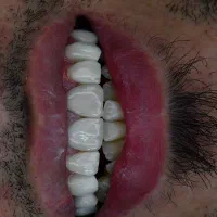 کامپوزیت و لمینیت اقساط|خدمات آرایشگری و زیبایی|اصفهان, ملک|دیوار