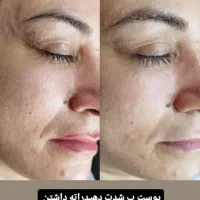 فشیال تخصصی با بهترین برند اکلدو