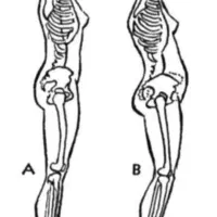 بدنِ خسته‌ت نیاز به توجه داره (کلاس اصلاحی بانوان)|خدمات آموزشی|گرگان, |دیوار