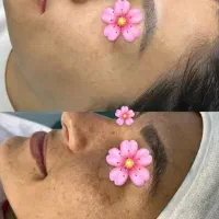 آفر های ویژه مرکز کلینیکی دکتر چوکامی تا عید مبعث