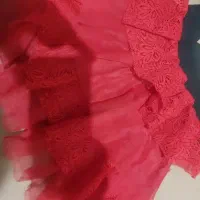 لباس دخترانه