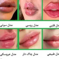 تزریق فیلر و بوتاکس و هایفو|خدمات آرایشگری و زیبایی|تهران, شهر زیبا|دیوار