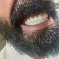 دندانسازی دندان مصنوعی|خدمات آرایشگری و زیبایی|مشهد, هفت تیر (آب و برق)|دیوار