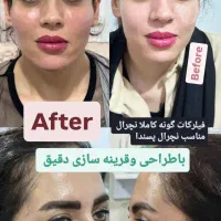آموزش وتزریق،ژل،بوتاکس،مزوژل زیرچشم،آنزیم ومزو|خدمات آرایشگری و زیبایی|کرج, فاز ۳ گوهردشت|دیوار