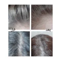 تونیک تقویت کننده مو|آرایشی، بهداشتی، درمانی|خرمآباد, |دیوار