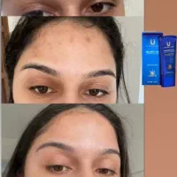 زیبایی صورت|آرایشی، بهداشتی، درمانی|خاش, |دیوار