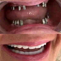 دندانپزشکی مرکز تخصصی ایمپلنت در تبریز|خدمات آرایشگری و زیبایی|مرند, |دیوار