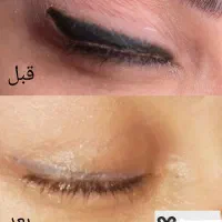 ریموو تاتو ابرو و خط چشم