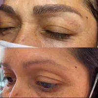 لـیزر موهای زائد/الکساندرایت/پی ار پی/پاککردن تاتو|خدمات آرایشگری و زیبایی|مشهد, آزادشهر|دیوار