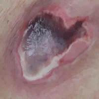 کارشناس زخم/خدمات تخصصی پرستاری در منزل|خدمات آرایشگری و زیبایی|اصفهان, شهید رجایی|دیوار