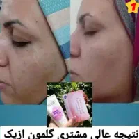 صابون ضدلک|آرایشی، بهداشتی، درمانی|تربت‌حیدریه, یحیی آباد|دیوار