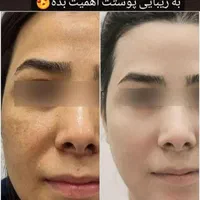 کرم طلا وصابون شراب|آرایشی، بهداشتی، درمانی|مهاباد (آذربایجان غربی), |دیوار