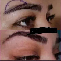 آف جراحی بینی ۲۰ت ولیپوساکشن وابدودراهواز