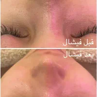 آموزش فیشال و پاکسازی پوست + تخفیف و پرداخت ۲ قسطی|خدمات آموزشی|شیراز, فرهنگ شهر|دیوار