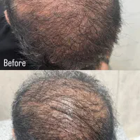 جشنواره پاییزی خدمات زیبایی|خدمات آرایشگری و زیبایی|بوشهر, |دیوار