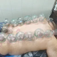 حجامت ، بادکش درمانی، مزاج شناسی|خدمات آرایشگری و زیبایی|اهواز, زیتون کارگری|دیوار