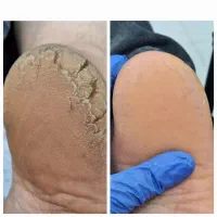 دکتر پا ،درمانگر ناخن و پوست|خدمات آرایشگری و زیبایی|یاسوج, |دیوار