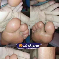 پدیکور و مانیکور حرفه ای با تخفیف تابستانه|خدمات آرایشگری و زیبایی|کرج, بنیاد|دیوار