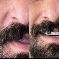 دندانسازی مصنوعی دندان مصنوعی با کیفیت و زیبا|خدمات آرایشگری و زیبایی|تبریز, |دیوار