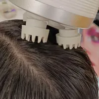 خدمات اسکراب اسکالپ (پاکسازی کف سر)
