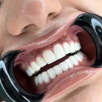 خدمات دندانپزشکی کامپوزیت لمینت عصب کشی|خدمات آرایشگری و زیبایی|تهران, تهرانپارس غربی|دیوار