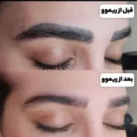 پاک کردن تخصصی تتو و خدمات آرایش دائم