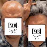 مرکزتخصصی پروتز مو