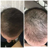 جذابیت رو بخودت هدیه کن