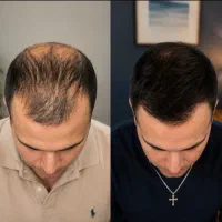 وقتشه به موهات برسی