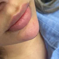 زیبایی ژل و بوتاکس|خدمات آرایشگری و زیبایی|اهواز, کیان اباد|دیوار