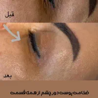 فیشال و پاکسازی پوست مخصوص بانوان