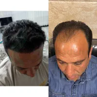 کاشتمو ده میلیون در شیراز