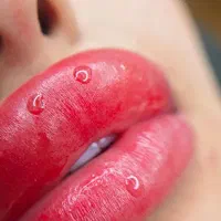 مدل میکروبلیدینگ و شیدلب فوری