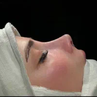 عمل زیبایی بینی در تهران با فوق تخصص نقد و اقساط|خدمات آرایشگری و زیبایی|اصفهان, فرح آباد|دیوار