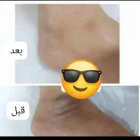 کرم بدن نقره|آرایشی، بهداشتی، درمانی|خاش, |دیوار