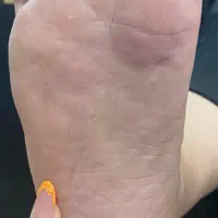 -رفع ترک و پینه پا با تکنیک تخصصی|خدمات آرایشگری و زیبایی|قائم‌شهر, |دیوار