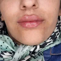 کامپوزیت دندان و ژل لب بزن سکه طلا هدیه بگیر|خدمات آرایشگری و زیبایی|اهواز, کیانپارس |دیوار