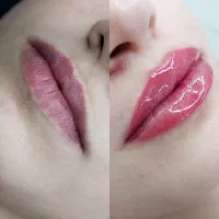 جشنواره آرایش دائم،میکروبلیدینگ،شیدلب،چشمریمو،لیفت