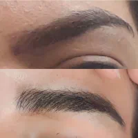 انجام میکرو بلیدینگ ابرو