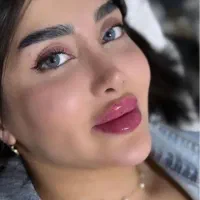 جشنواره فیلر ،ژل ،بوتاکس و پی آر پی و اسکار صورت