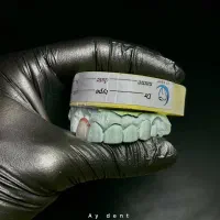 کار آموز دندانسازی