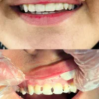 دندانپزشکی با پرداخت یک سوم هزینه|خدمات آرایشگری و زیبایی|سقز, |دیوار